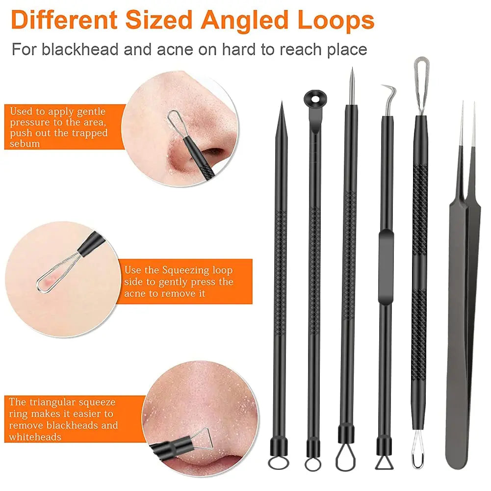 6-Piece Blackhead Removal Tool Set, Capable Of Removing Facial Blackheads, Pimples, Acne, Etc., Keeping The Skin Clean