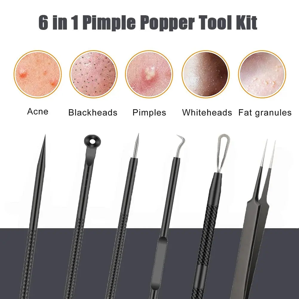 6-Piece Blackhead Removal Tool Set, Capable Of Removing Facial Blackheads, Pimples, Acne, Etc., Keeping The Skin Clean
