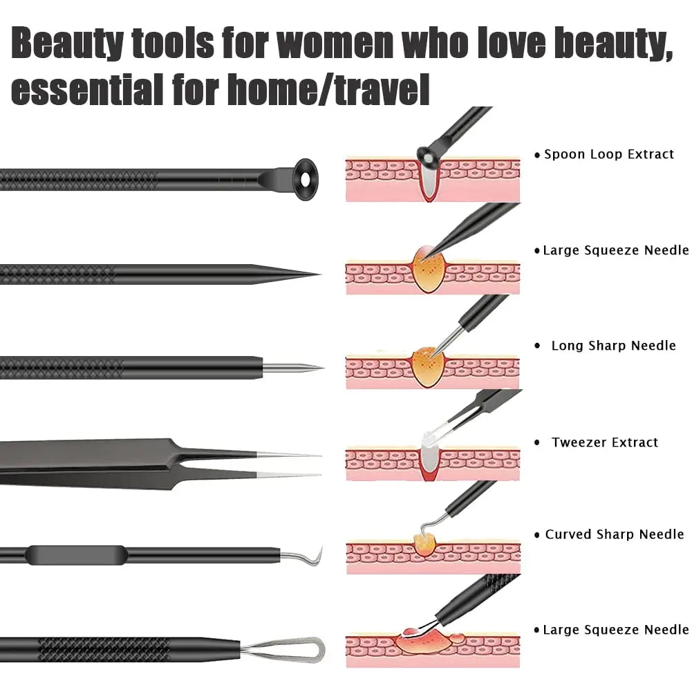 6-Piece Blackhead Removal Tool Set, Capable Of Removing Facial Blackheads, Pimples, Acne, Etc., Keeping The Skin Clean