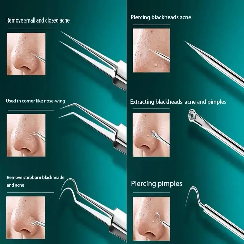 11Pcs/Set Acne Needle Blackhead Clip Remover Extraction Pore Black Head Cleaner Face Skin Care Cleansing Needle Tool Cell Clamp